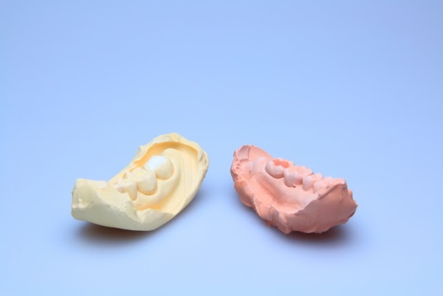 入歯の調整・作成の様子1